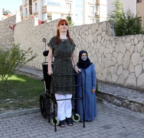 Dünyanın En Uzun Kadını Rumeysa Gelgi